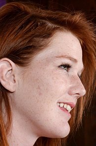 Sweet Redhead Girl With Freckles On Face
